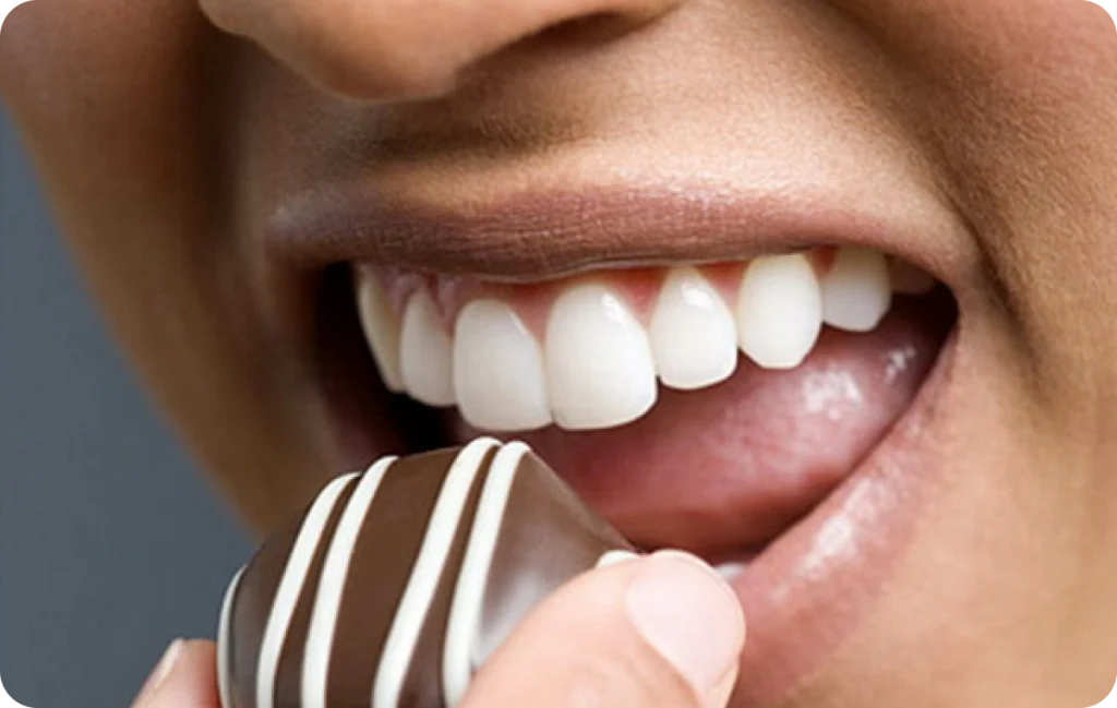 eclaircissement dentaire chevreuse sourire lumineux Conseils pré-opératoires Cabinet Dental Vallée | Dentistes Chevreuse