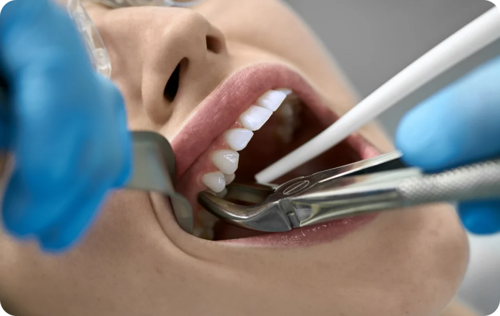 extraction implantation chevreuse Conseils pré-opératoires Cabinet Dental Vallée | Dentistes Chevreuse