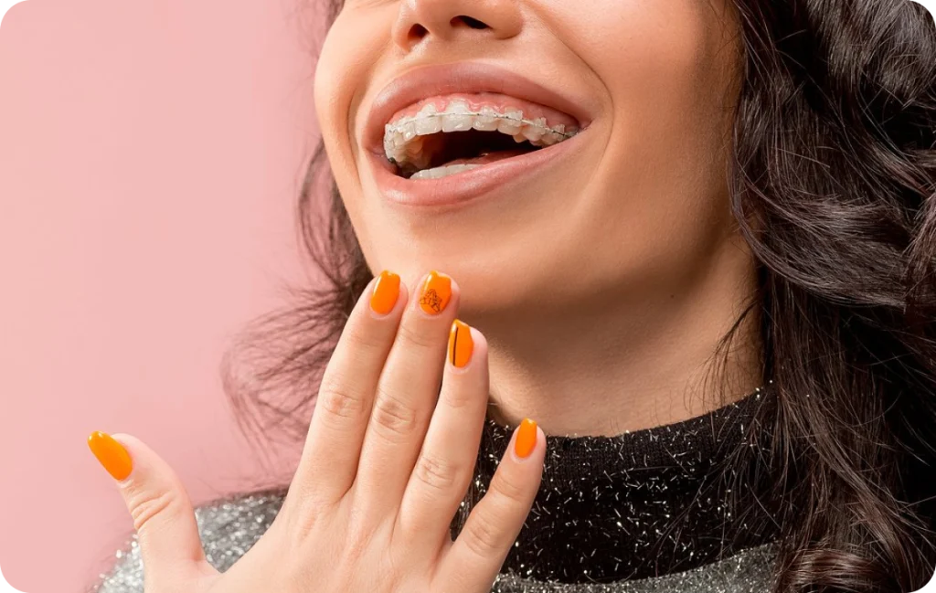 appareils dentaires ceramique chevreuse Appareils dentaires Cabinet Dental Vallée | Dentistes Chevreuse