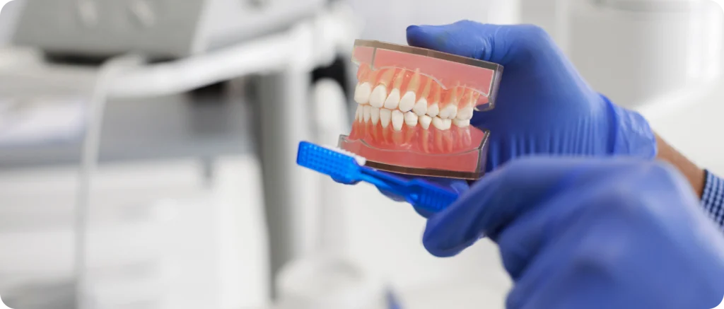 blanchiment dentaire chevreuse teinte naturelle Prévention, dépistage des maladies parodontales Cabinet Dental Vallée | Dentistes Chevreuse