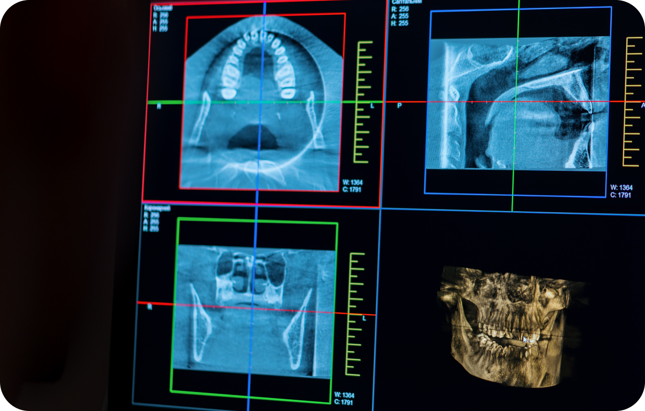 clinique dentaire chevreuse qualite soins Notre сabinet Cabinet Dental Vallée | Dentistes Chevreuse