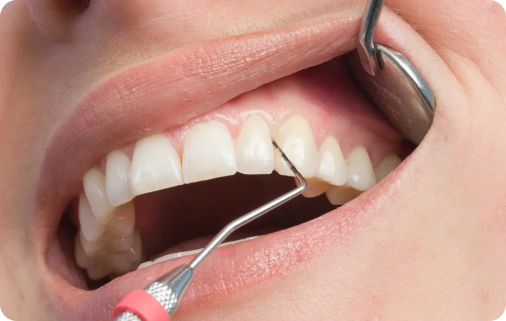 soins dentaires chevreuse approche globale Prévention, dépistage des maladies parodontales Cabinet Dental Vallée | Dentistes Chevreuse